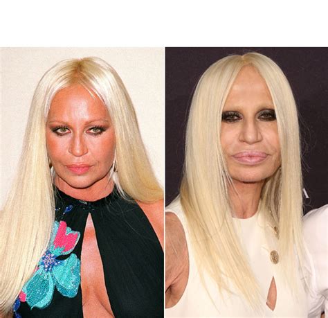 donatella versace what happened|donatella versace plastic surgery 2022.